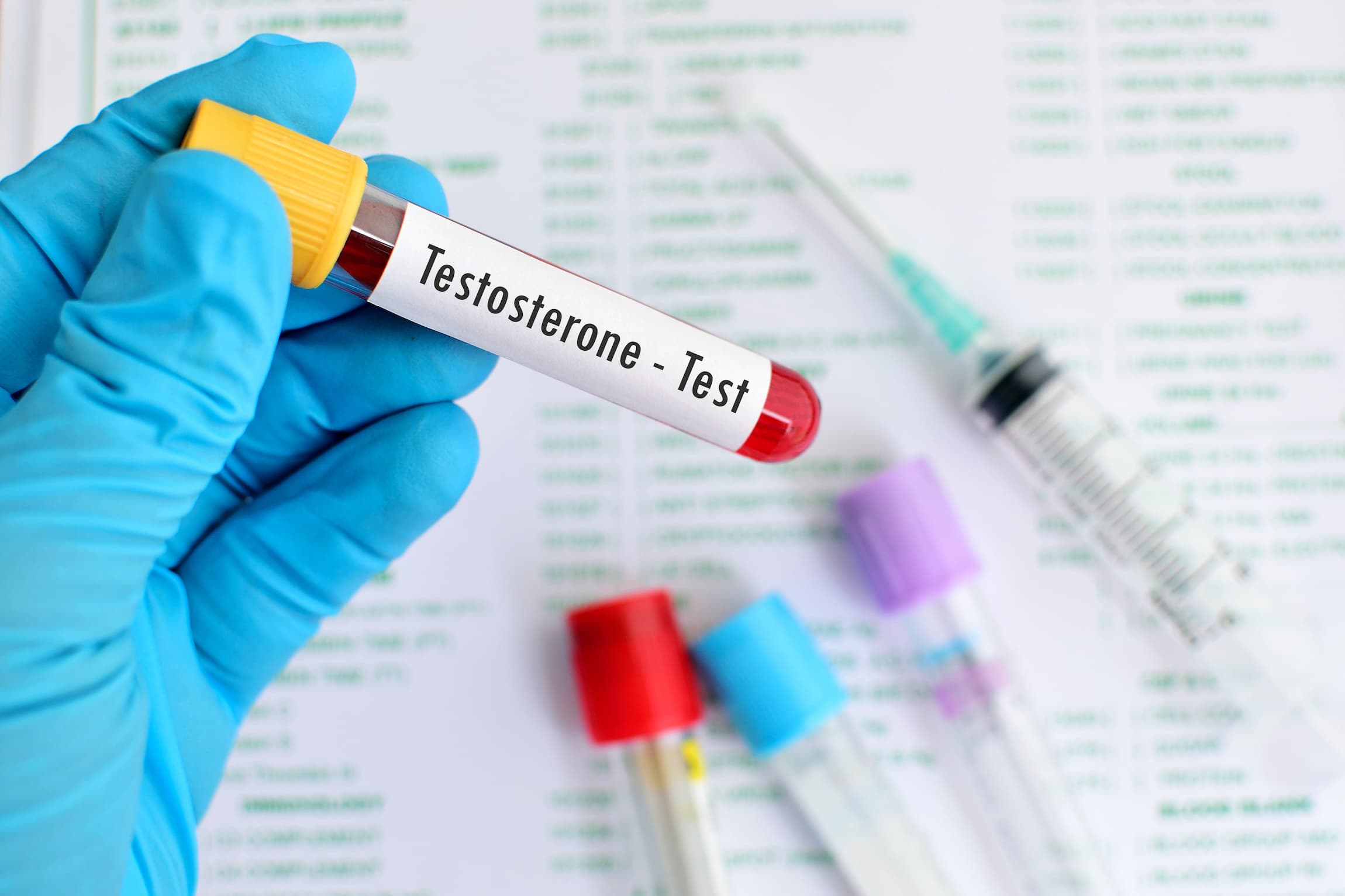 Blood sample for male hormone testing