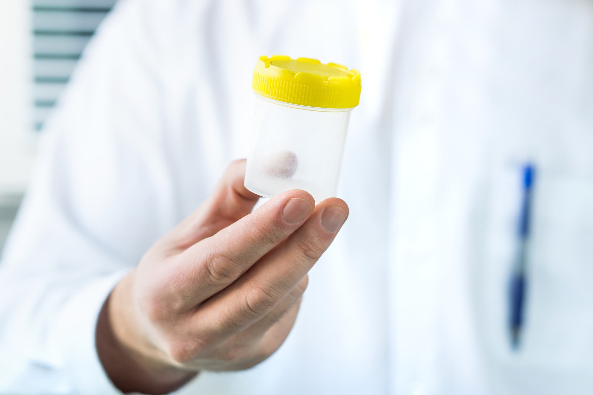 Doctor holding a medical sample cup