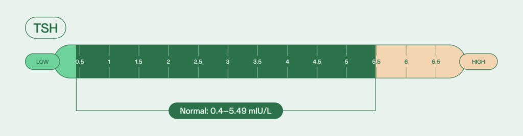 hyperthyroidism and male fertility: TSH normal levels 0.4–5.49 mIU/L