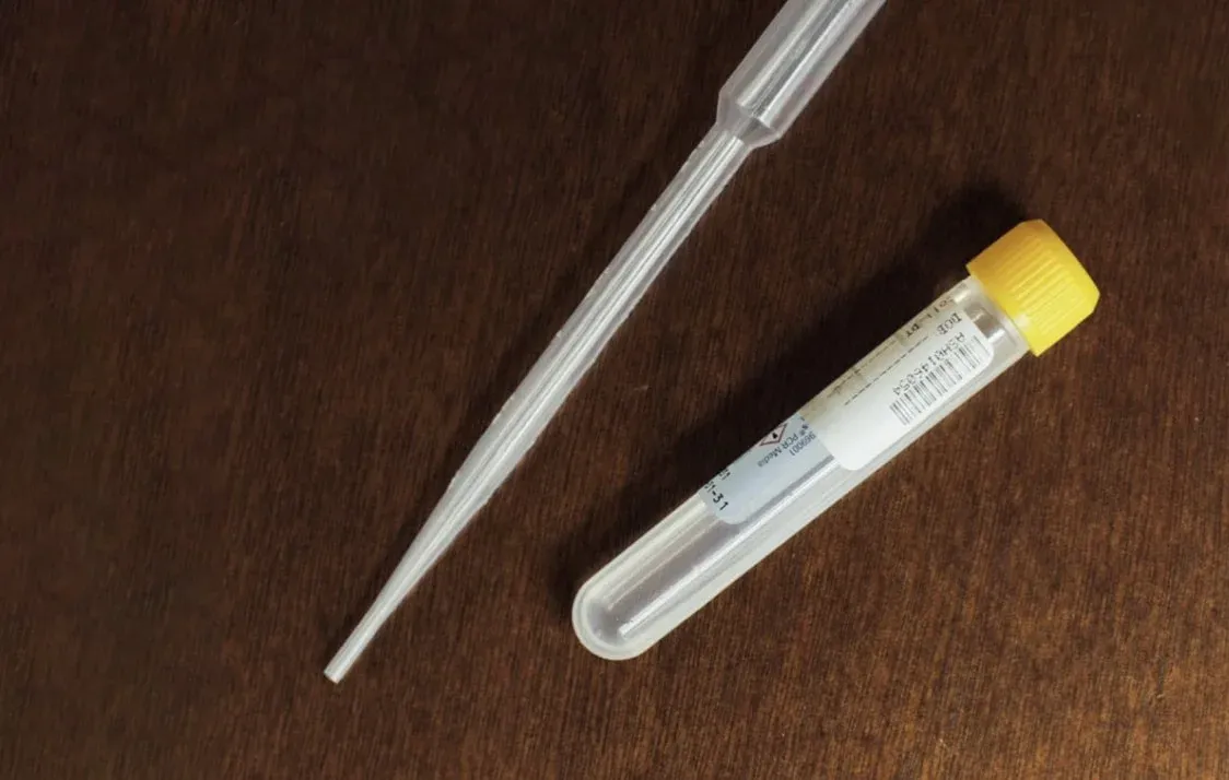 urine-sample urine-sample
